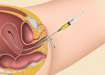 The Step-by-Step Journey Through an IVF Cycle